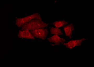 PRKY Antibody - Staining HepG2 cells by IF/ICC. The samples were fixed with PFA and permeabilized in 0.1% Triton X-100, then blocked in 10% serum for 45 min at 25°C. The primary antibody was diluted at 1:200 and incubated with the sample for 1 hour at 37°C. An Alexa Fluor 594 conjugated goat anti-rabbit IgG (H+L) Ab, diluted at 1/600, was used as the secondary antibody.