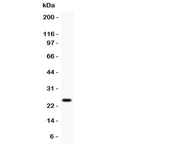 PRL / Prolactin Antibody - Western blot testing of Prolactin antibody and MCF7 lysate. Predicted/observed size ~25KD