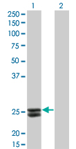 PRL / Prolactin Antibody - Western Blot analysis of PRL expression in transfected 293T cell line by PRL monoclonal antibody (M02), clone 1E1.Lane 1: PRL transfected lysate(25.9 KDa).Lane 2: Non-transfected lysate.