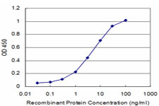PRL / Prolactin Antibody - Detection limit for recombinant GST tagged PRL is approximately 0.3 ng/ml as a capture antibody.