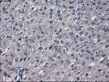 PRL / Prolactin Antibody - IHC of paraffin-embedded liver tissue using anti-PRL mouse monoclonal antibody. (Dilution 1:50).