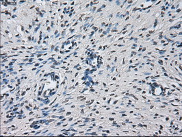 PRL / Prolactin Antibody - IHC of paraffin-embedded Ovary tissue using anti-PRL mouse monoclonal antibody. (Dilution 1:50).