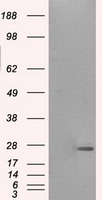 PRL / Prolactin Antibody - HEK293T cells were transfected with the pCMV6-ENTRY control (Left lane) or pCMV6-ENTRY PRL (Right lane) cDNA for 48 hrs and lysed. Equivalent amounts of cell lysates (5 ug per lane) were separated by SDS-PAGE and immunoblotted with anti-PRL.