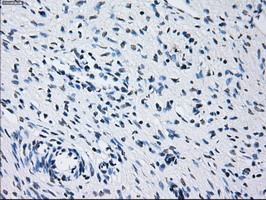 PRL / Prolactin Antibody - Immunofluorescent staining of HepG2 cells using anti-PRL mouse monoclonal antibody.