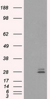 PRL / Prolactin Antibody - HEK293T cells were transfected with the pCMV6-ENTRY control (Left lane) or pCMV6-ENTRY PRL (Right lane) cDNA for 48 hrs and lysed. Equivalent amounts of cell lysates (5 ug per lane) were separated by SDS-PAGE and immunoblotted with anti-PRL.