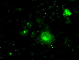 PRL / Prolactin Antibody - Anti-PRL mouse monoclonal antibody  immunofluorescent staining of COS7 cells transiently transfected by pCMV6-ENTRY PRL.