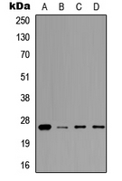 PRL / Prolactin Antibody - Western blot analysis of Prolactin expression in A549 (A); MCF7 (B); NS-1 (C); H9C2 (D) whole cell lysates.