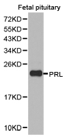 PRL / Prolactin Antibody - Western blot of extracts of fetal pituitary cell lines, using PRL antibody.
