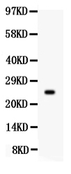 PRL / Prolactin Antibody - anti-Prolactin Picoband antibody, PB361, Western blotting All lanes: Anti Prolactin at 0.5ug/ml WB: MCF-7 Whole Cell Lysate at 40ug Predicted bind size: 25KD Observed bind size: 25KD