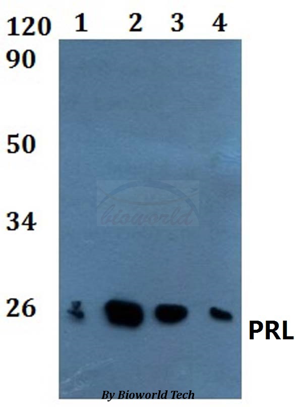 PRL / Prolactin Antibody - Western blot of PRL antibody at 1:500 dilution. Lane 1: A549 whole cell lysate. Lane 2: MCF-7 whole cell lysate. Lane 3: H9C2 whole cell lysate. Lane 4: SP20 whole cell lysate.