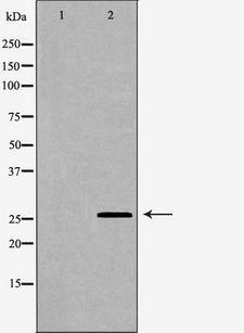 PRL / Prolactin Antibody - Western blot analysis of extracts of fetal pituitary using PRL antibody. The lane on the left is treated with the antigen-specific peptide.