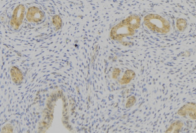 PRL / Prolactin Antibody - 1:100 staining human uterus tissue by IHC-P. The sample was formaldehyde fixed and a heat mediated antigen retrieval step in citrate buffer was performed. The sample was then blocked and incubated with the antibody for 1.5 hours at 22°C. An HRP conjugated goat anti-rabbit antibody was used as the secondary.