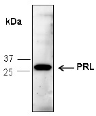 PRL / Prolactin Antibody - Western blot analysis of recombinant human PRL, using anti-PRL antibody (1 :1,000)