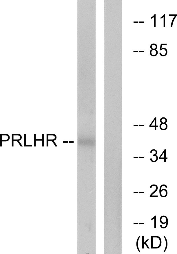 PRLHR / GPR10 Antibody - Western blot analysis of lysates from Jurkat cells, using PRLHR Antibody. The lane on the right is blocked with the synthesized peptide.