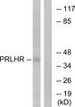 PRLHR / GPR10 Antibody - Western blot analysis of lysates from Jurkat cells, using PRLHR Antibody. The lane on the right is blocked with the synthesized peptide.