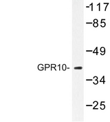 PRLHR / GPR10 Antibody - Western blot of GPR10 (Q223) pAb in extracts from Jurkat cells.