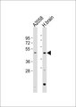 PRLHR / GPR10 Antibody - All lanes: Anti-GPR10 Antibody at 1:1000 dilution. Lane 1: A2058 whole cell lysate. Lane 2: human brain lysate Lysates/proteins at 20 ug per lane. Secondary Goat Anti-Rabbit IgG, (H+L), Peroxidase conjugated at 1:10000 dilution. Predicted band size: 41 kDa. Blocking/Dilution buffer: 5% NFDM/TBST.