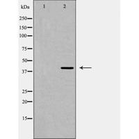 PRLHR / GPR10 Antibody - Western blot of PRLHR expression in Jurkat cell extract