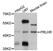 PRLHR / GPR10 Antibody - Western blot analysis of extracts of various cell lines, using PRLHR antibody at 1:1000 dilution. The secondary antibody used was an HRP Goat Anti-Rabbit IgG (H+L) at 1:10000 dilution. Lysates were loaded 25ug per lane and 3% nonfat dry milk in TBST was used for blocking. An ECL Kit was used for detection and the exposure time was 30s.