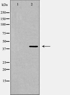 PRLHR / GPR10 Antibody - Western blot analysis of PRLHR expression in Jurkat cells extract. The lane on the left is treated with the antigen-specific peptide.