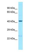 PRLHR / GPR10 Antibody - PRLHR / GPR10 antibody Western Blot of MCF7.  This image was taken for the unconjugated form of this product. Other forms have not been tested.