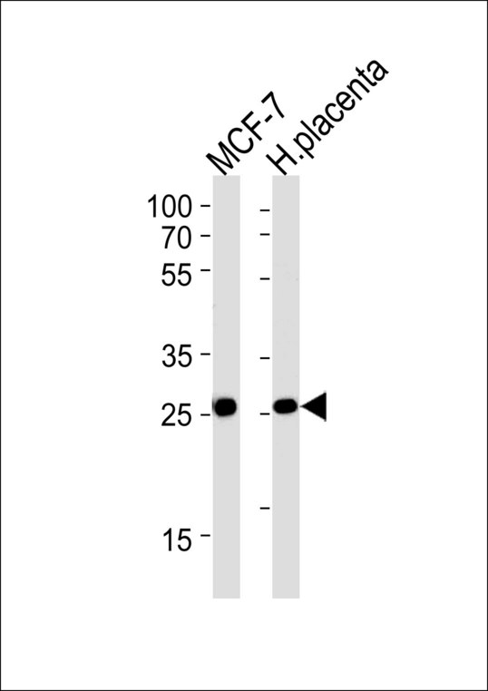 PRLR / Prolactin Receptor Antibody - PRLR Antibody western blot of MCF-7 cell line and human placenta tissue lysates (35 ug/lane). The PRLR antibody detected the PRLR protein (arrow).