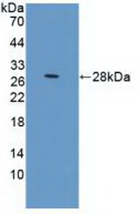 PRLR / Prolactin Receptor Antibody