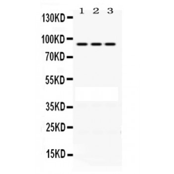 PRLR / Prolactin Receptor Antibody - PRLR antibody Western blot. All lanes: Anti PRLR at 0.5 ug/ml. Lane 1: HELA Whole Cell Lysate at 40 ug. Lane 2: SGC Whole Cell Lysate at 40 ug. Lane 3: SW620 Whole Cell Lysate at 40 ug. Predicted band size: 90 kD. Observed band size: 90 kD.