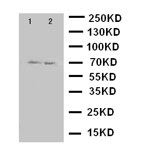 PRLR / Prolactin Receptor Antibody - WB of PRLR / Prolactin Receptor antibody. Lane 1: HELA Cell Lysate. Lane 2: MCF-7 Cell Lysate.