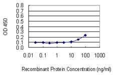 PRLR / Prolactin Receptor Antibody - Detection limit for recombinant GST tagged PRLR is 10 ng/ml as a capture antibody.
