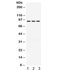 PRLR / Prolactin Receptor Antibody
