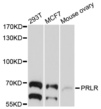 PRLR / Prolactin Receptor Antibody - Western blot analysis of extracts of various cell lines, using PRLR antibody at 1:1000 dilution. The secondary antibody used was an HRP Goat Anti-Rabbit IgG (H+L) at 1:10000 dilution. Lysates were loaded 25ug per lane and 3% nonfat dry milk in TBST was used for blocking. An ECL Kit was used for detection and the exposure time was 60s.