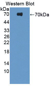 PRLTS / PDGFRL Antibody - Western blot of PRLTS / PDGFRL antibody.