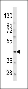 PRLTS / PDGFRL Antibody - Western blot of anti-PDGFRL Antibody in HeLa cell line lysates (35 ug/lane). PDGFRL(arrow) was detected using the purified antibody.