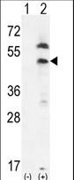 PRLTS / PDGFRL Antibody - Western blot of PDGFRL (arrow) using rabbit polyclonal PDGFRL-T343. 293 cell lysates (2 ug/lane) either nontransfected (Lane 1) or transiently transfected (Lane 2) with the PDGFRL gene.