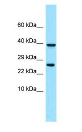 PRLTS / PDGFRL Antibody - PRLTS / PDGFRL antibody Western Blot of RPMI-8226.  This image was taken for the unconjugated form of this product. Other forms have not been tested.