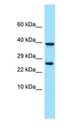 PRLTS / PDGFRL Antibody - PRLTS / PDGFRL antibody Western Blot of RPMI-8226.  This image was taken for the unconjugated form of this product. Other forms have not been tested.
