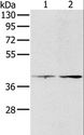 PRLTS / PDGFRL Antibody - Western blot analysis of HeLa and LOVO cell, using PDGFRL Polyclonal Antibody at dilution of 1:400.