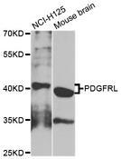 PRLTS / PDGFRL Antibody - Western blot analysis of extracts of various cell lines.