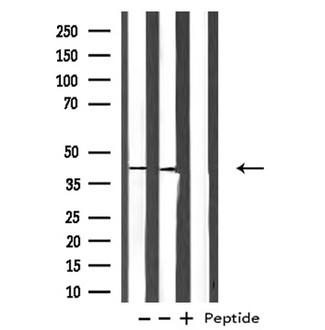 PRLTS / PDGFRL Antibody - Western blot analysis of Histone PDGFRL expression in various lysates