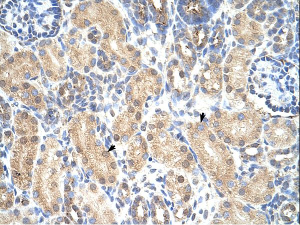 PRMT1 Antibody - PRMT1 antibody ARP40198_T100-NP_001527-PRMT1 (protein arginine methyltransferase 1) Antibody was used in IHC to stain formalin-fixed, paraffin-embedded human kidney.  This image was taken for the unconjugated form of this product. Other forms have not been tested.
