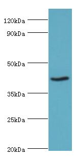 PRMT1 Antibody - Western blot. All lanes: Protein arginine N-methyltransferase 1 antibody at 2 ug/ml+NIH3T3 whole cell lysate. Secondary antibody: Goat polyclonal to rabbit at 1:10000 dilution. Predicted band size: 43 kDa. Observed band size: 43 kDa Immunohistochemistry.