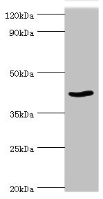 PRMT1 Antibody - Western blot All lanes: Protein arginine N-methyltransferase 1 antibody at 2µg/ml + NIH/3T3 whole cell lysate Secondary Goat polyclonal to rabbit IgG at 1/10000 dilution Predicted band size: 42, 40, 41 kDa Observed band size: 42 kDa