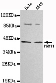 PRMT1 Antibody - Western blot detection of PRMT1 in Hela&A549 cell lysates using PRMT1 antibody (1:1000 diluted).