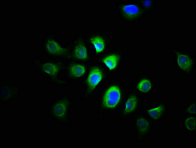 PRMT1 Antibody - Immunofluorescence staining of A549 cells with PRMT1 Antibody at 1:166, counter-stained with DAPI. The cells were fixed in 4% formaldehyde, permeabilized using 0.2% Triton X-100 and blocked in 10% normal Goat Serum. The cells were then incubated with the antibody overnight at 4°C. The secondary antibody was Alexa Fluor 488-congugated AffiniPure Goat Anti-Rabbit IgG(H+L).