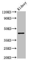 PRMT1 Antibody - Western Blot Positive WB detected in: Mouse kidney tissue All lanes: HRMT1L2 antibody at 2.5µg/ml Secondary Goat polyclonal to rabbit IgG at 1/50000 dilution Predicted band size: 42, 40, 41 kDa Observed band size: 42 kDa