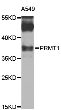PRMT1 Antibody - Western blot analysis of extracts of A-549 cells, using PRMT1 antibody at 1:1000 dilution. The secondary antibody used was an HRP Goat Anti-Rabbit IgG (H+L) at 1:10000 dilution. Lysates were loaded 25ug per lane and 3% nonfat dry milk in TBST was used for blocking. An ECL Kit was used for detection and the exposure time was 90s.