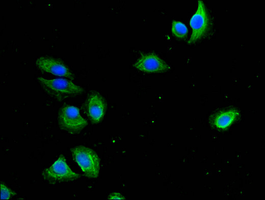 PRMT1 Antibody - Immunofluorescent analysis of A549 cells using PRMT1 Antibody at a dilution of 1:100 and Alexa Fluor 488-congugated AffiniPure Goat Anti-Rabbit IgG(H+L)