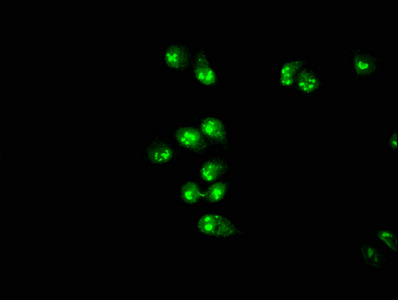 PRMT1 Antibody - Immunofluorescence staining of Hela cells with PRMT1 Antibody at 1:166, counter-stained with DAPI. The cells were fixed in 4% formaldehyde, permeabilized using 0.2% Triton X-100 and blocked in 10% normal Goat Serum. The cells were then incubated with the antibody overnight at 4°C. The secondary antibody was Alexa Fluor 488-congugated AffiniPure Goat Anti-Rabbit IgG(H+L).