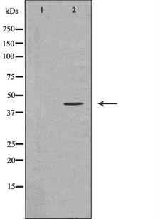 PRMT1 Antibody - Western blot analysis of HeLa cells using PRMT1 antibody. The lane on the left is treated with the antigen-specific peptide.